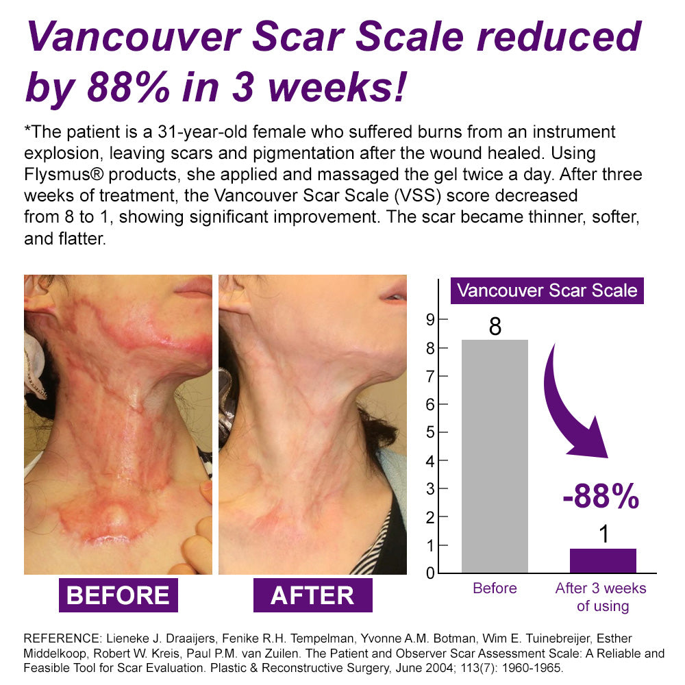 💙✅flysmus® cure FACE & BODY SCAR GEL