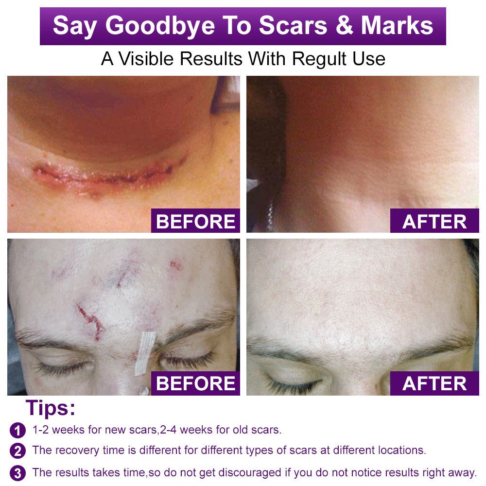 💙✅flysmus® cure FACE & BODY SCAR GEL