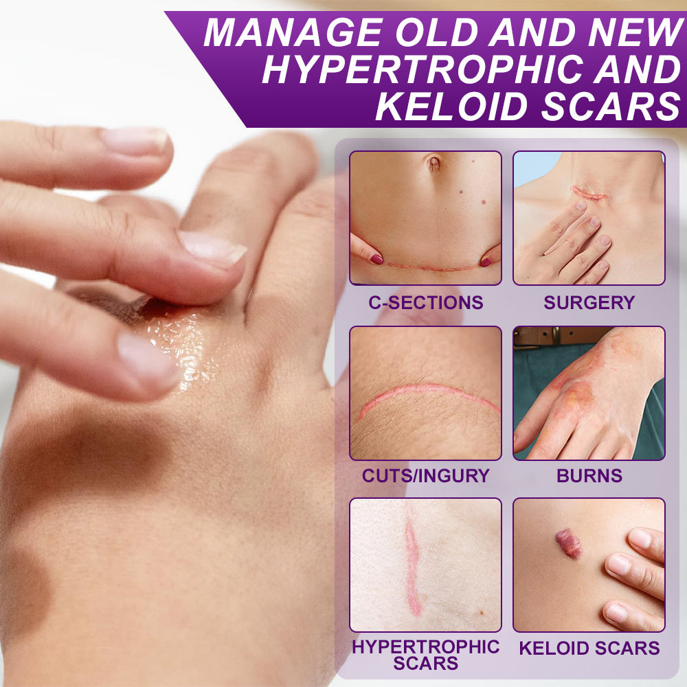 💙✅flysmus® cure FACE & BODY SCAR GEL