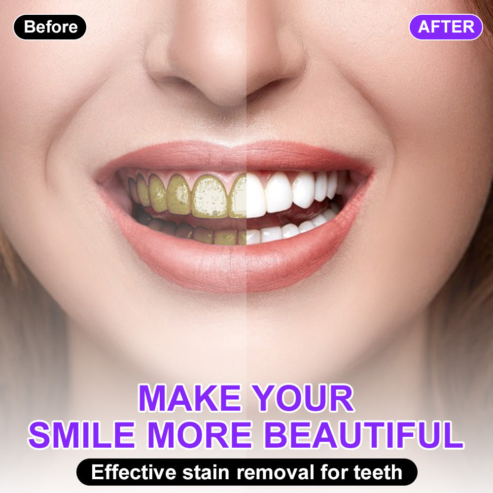 🦷 🦷𝐅𝐮𝐫𝐳𝐞𝐫𝐨®𝐂𝐨𝐥𝐨𝐮𝐫 𝐂𝐨𝐫𝐫𝐞𝐜𝐭𝐨𝐫 𝐒𝐞𝐫𝐮𝐦 — safe for sensitive teeth and enamel