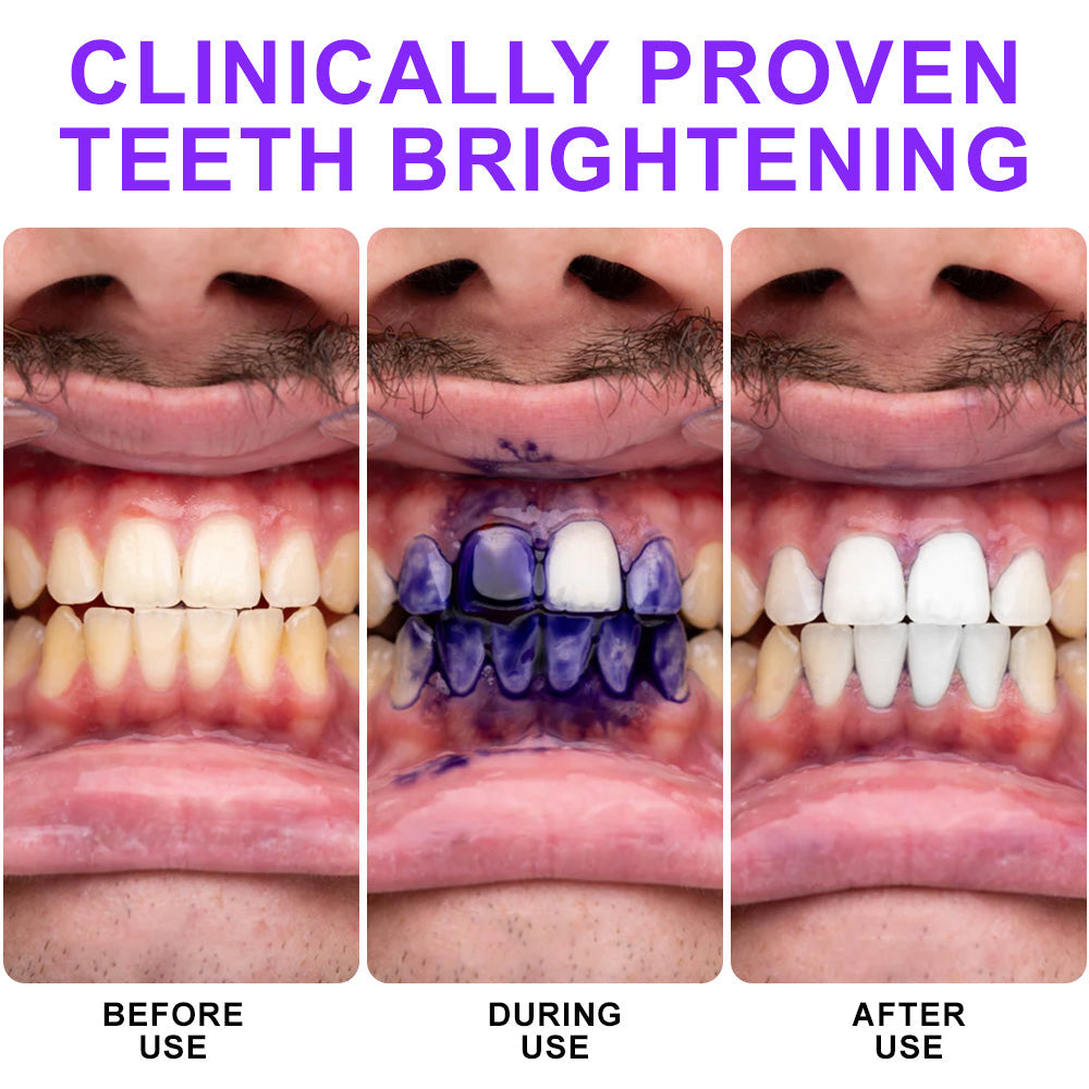 🦷 🦷𝐅𝐮𝐫𝐳𝐞𝐫𝐨®𝐂𝐨𝐥𝐨𝐮𝐫 𝐂𝐨𝐫𝐫𝐞𝐜𝐭𝐨𝐫 𝐒𝐞𝐫𝐮𝐦 — safe for sensitive teeth and enamel